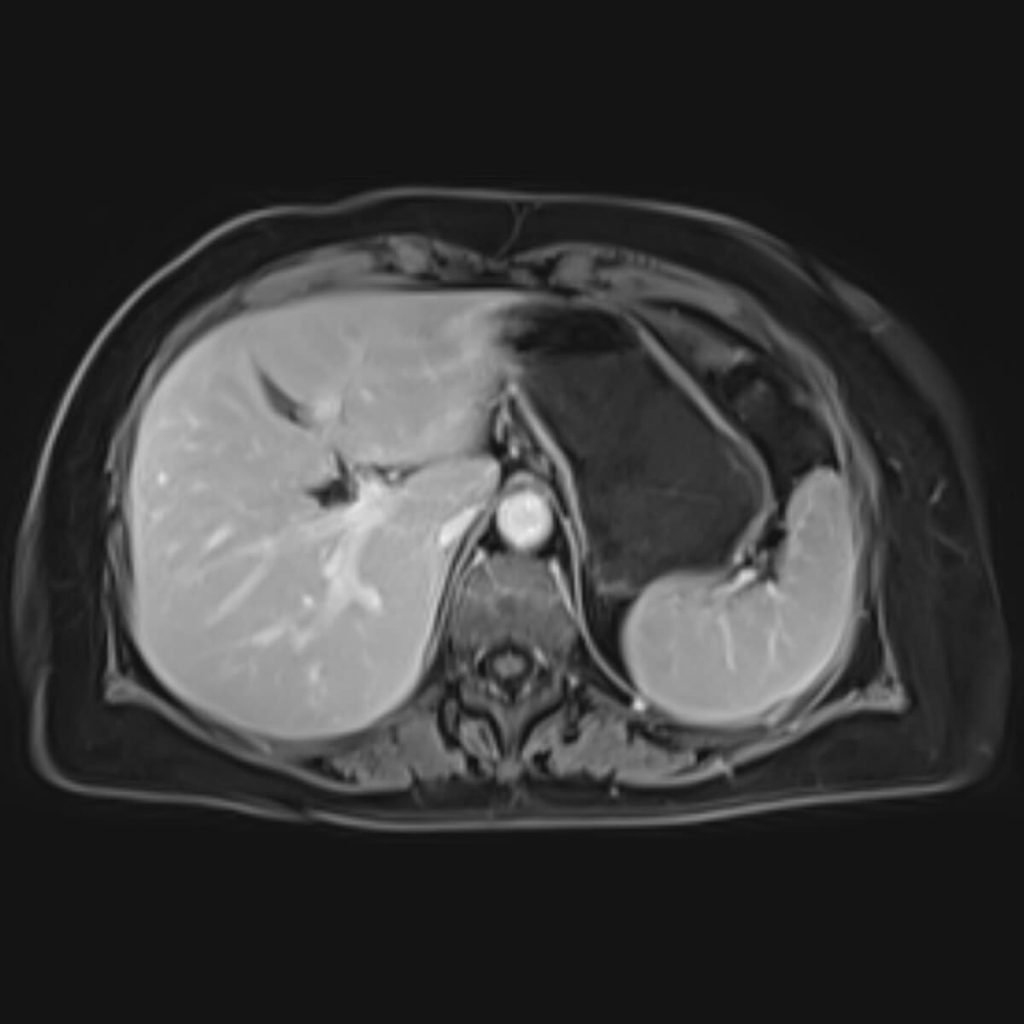 abdomen-mrt-frankfurt-am-main-dr-behrens-dr-schlo